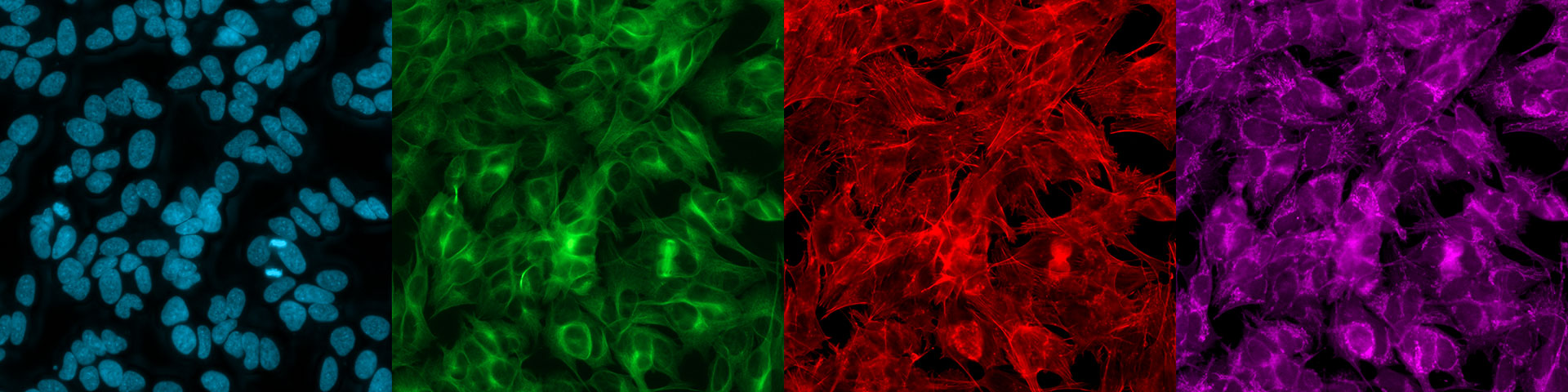 Hoechst – Chromatine (bleu), anticorps anti-alpha-tubuline FITC pour la tubuline alpha (vert), phalloïdine pour l'actine (rouge), MitoTracker Deep Red pour les mitochondries (violet).  Échantillon avec l'aimable autorisation de P. Denner, centre de recherche supérieur, centre allemand des maladies neuro-dégénérative (DZNE), Bonn, Allemagne.