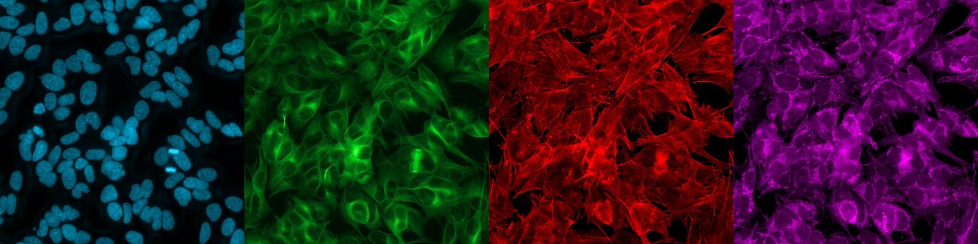 Hoechst – Chromatin (blau), anti-alpha Tubulin Antikörper FITC für alpha-Tubulin (grün), Phalloidin für Aktin (rot), MitoTracker Deep Red für Mitochondrien (violett). 