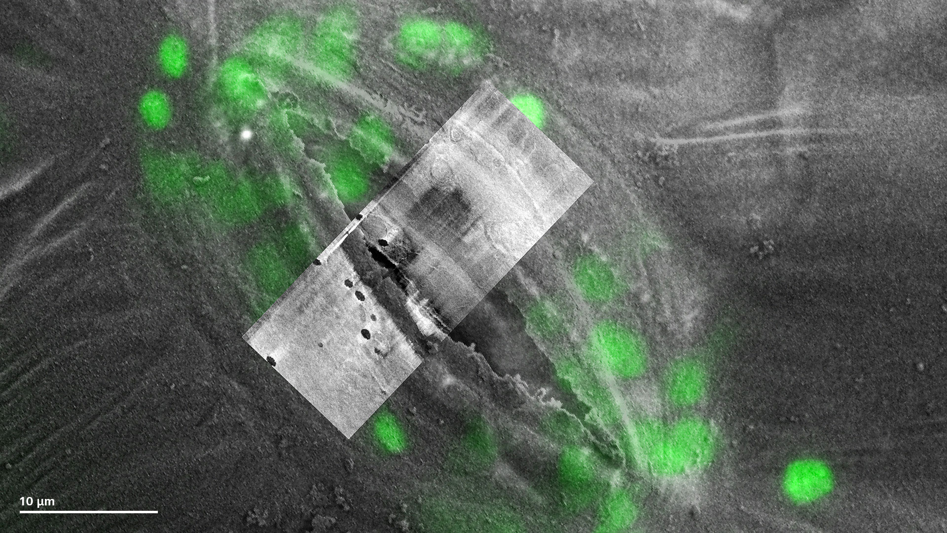 Stomata und internalisierte Plastide wurden mit dem LSM anhand der Autofluoreszenz der Probe erkannt. Das ausgewählte Stoma wurde relokalisiert und mit Crossbeam abgebildet.