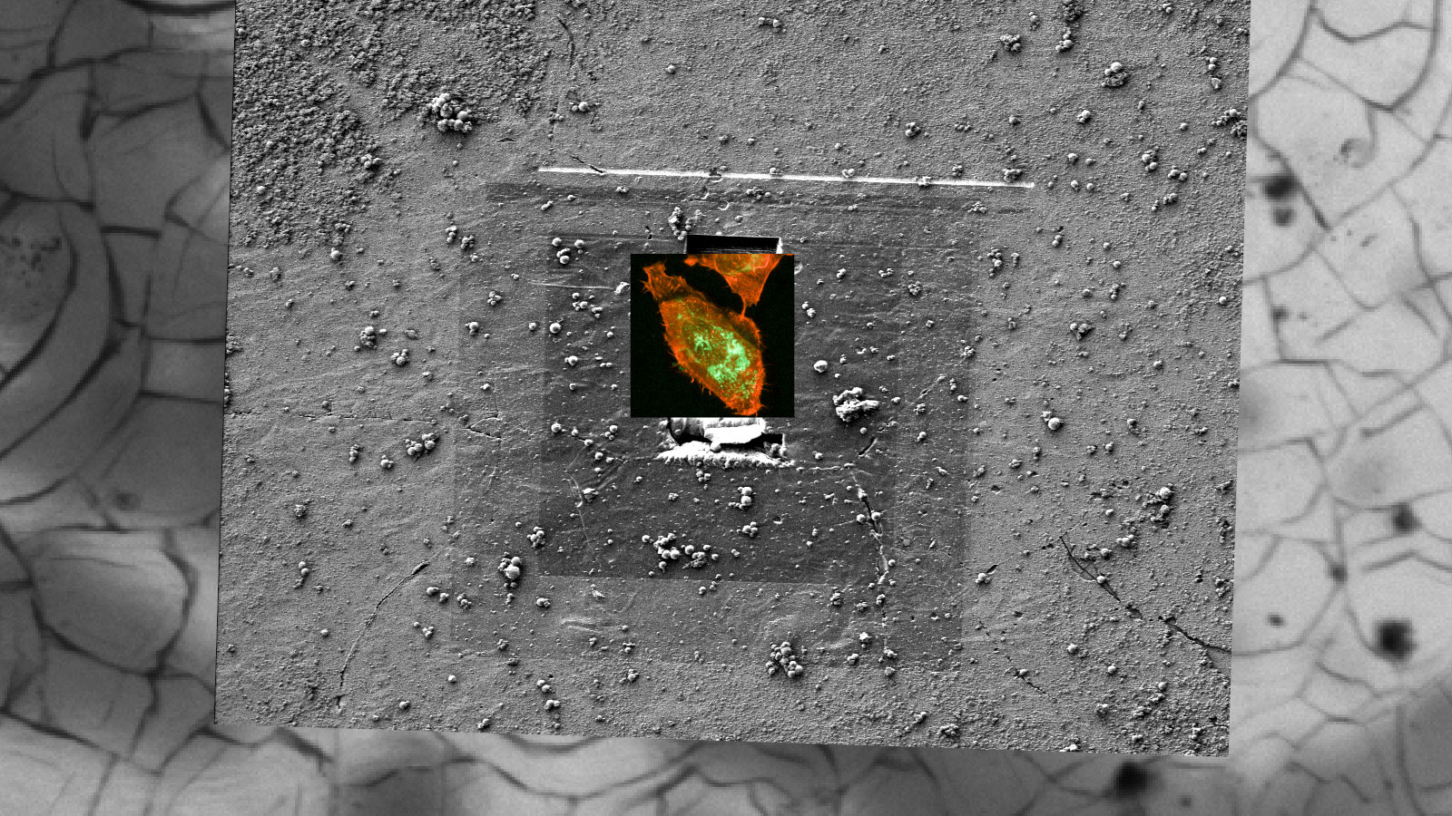 Tauchgefrorene Adenokarzinomzellen auf Saphirscheiben.