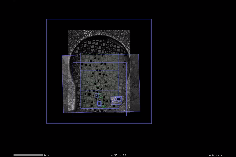 Superposition d'une image microscope à balayage laser/Airyscan haute résolution avec une image Crossbeam très contrastée acquise en conditions cryogéniques. La superposition a été réalisée avec ZEN Connect.