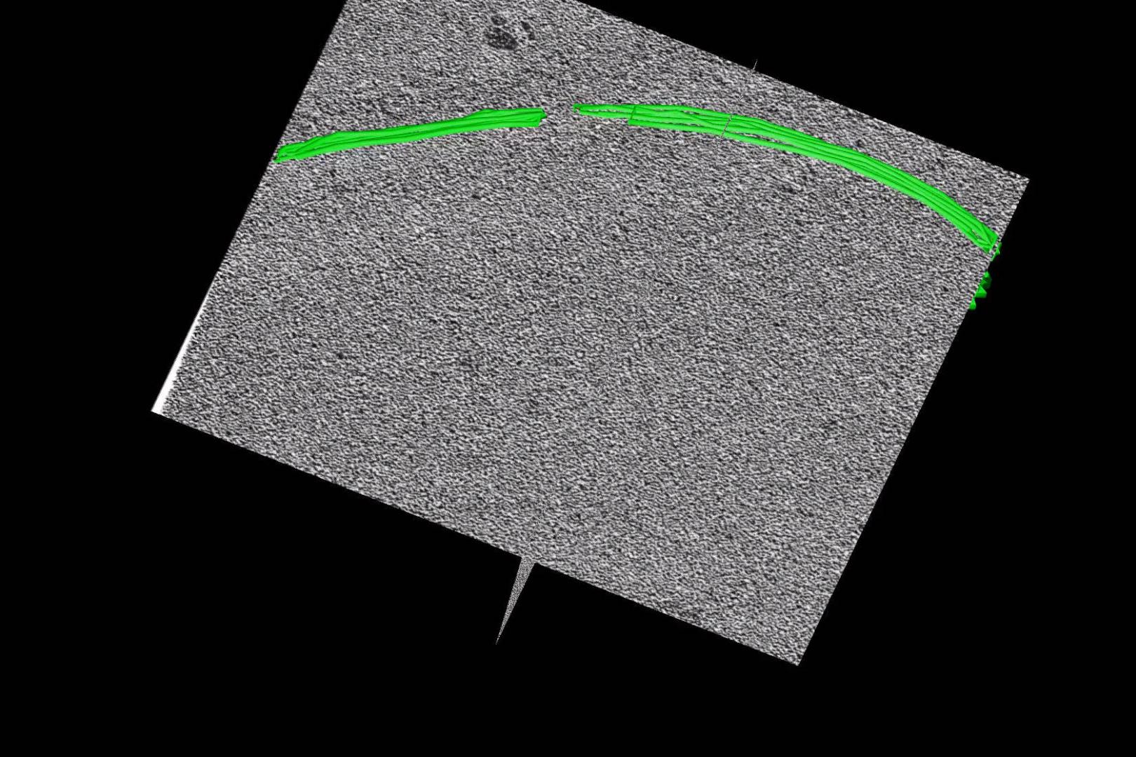 Segmented and reconstructed tomogram