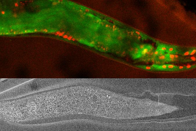 En haut : Une image du ver a été capturée à température cryogénique avec un système de microscope à balayage laser / Airyscan avant la substitution du gel. En bas : Une image du ver incrusté et coloré a ensuite été capturée avec Crossbeam.