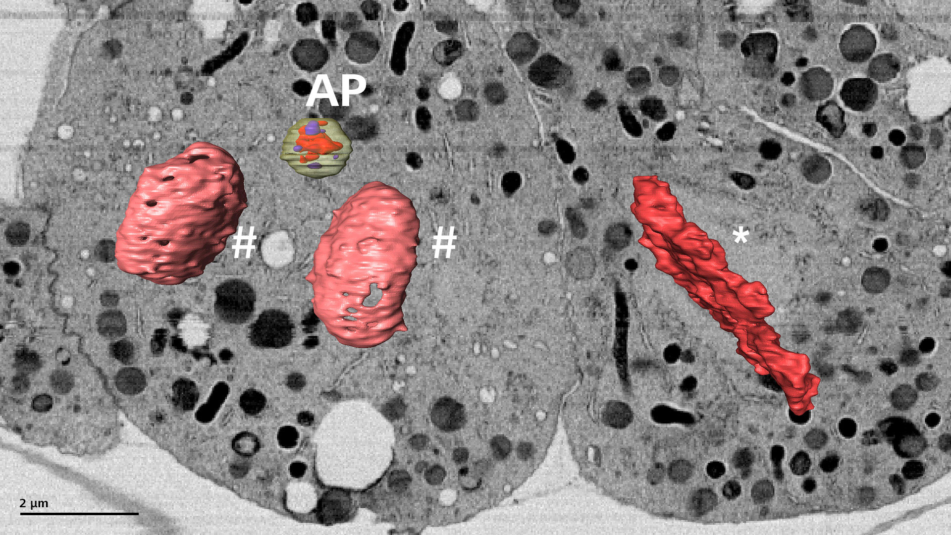 Rekonstruktion von Zellstrukturen wie einem Autophagosom (AP) oder dem Genom in verschiedenen mitotischen Phasen (*: Zelle in der Metaphase; #: Zelle in der Telophase). 