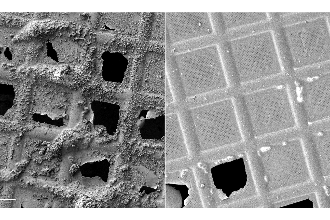 TEM-Grids mit vitrifizierten Proben