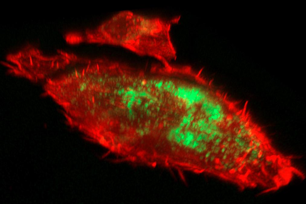 腺がん細胞の3Dイメージング。顕著なミトコンドリア核分裂パターンが示されている。