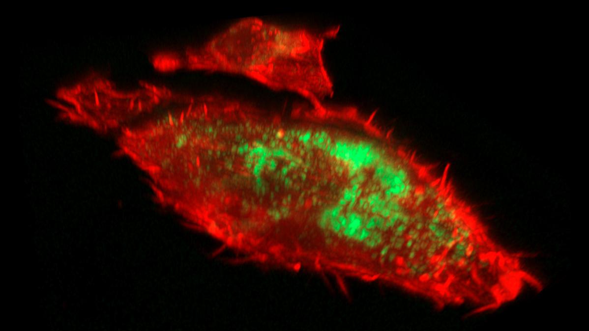腺がん細胞の3Dイメージング。顕著なミトコンドリア核分裂パターンが示されている。