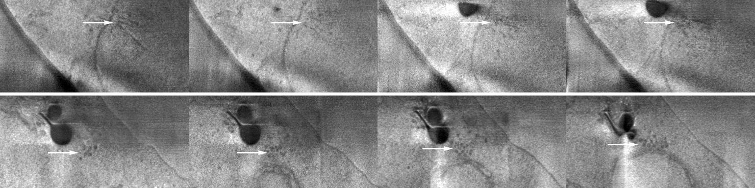 Corps polaire du fuseau en coupe longitudinale à l'intérieur de la membrane nucléaire (en haut) et microtubules en coupe transversale à l'extérieur de la membrane nucléaire (en bas). Taille d'incrément de l'image de la pile acquise : 50 nm