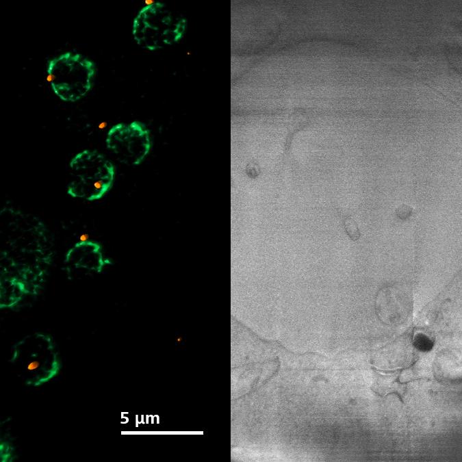 二重標識された酵母細胞（CNM67-tdTomatoおよびNUP-GFP）。LSM画像（左）とCrossbeam画像（右）。