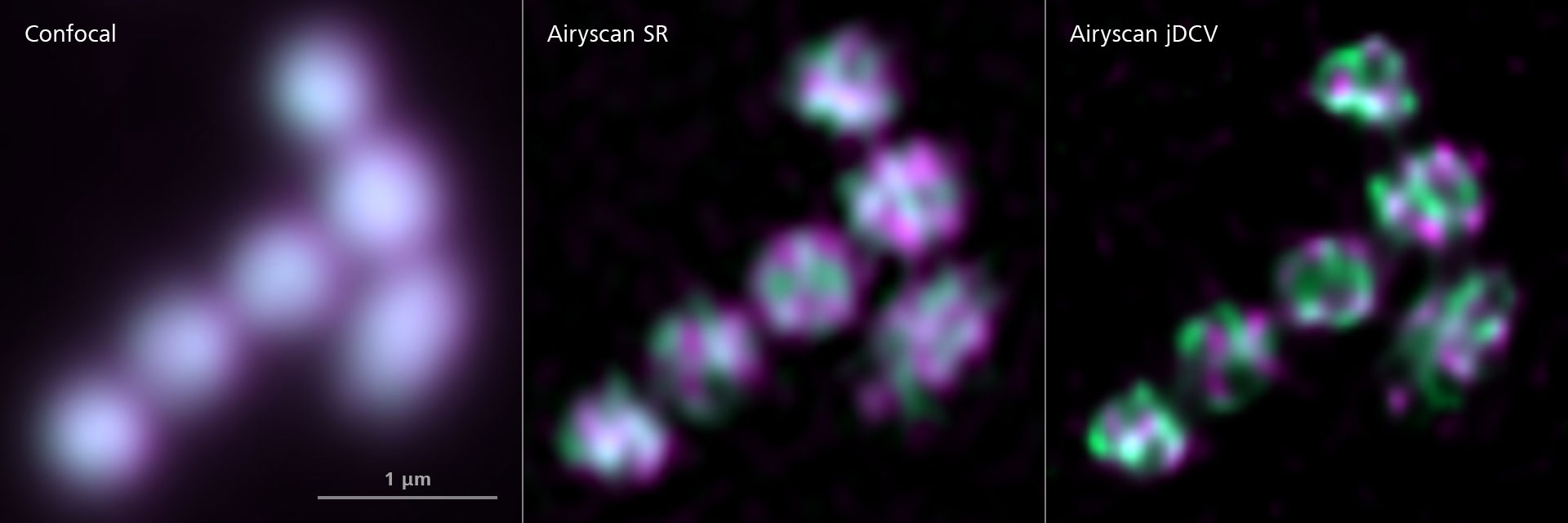 Mitochondria in an Arabidopsis thaliana cell. Comparing the confocal image with Airyscan SR and Airyscan Joint Deconvolution. Courtesy of J.-O. Niemeier, AG Schwarzländer, WWU Münster, Germany.