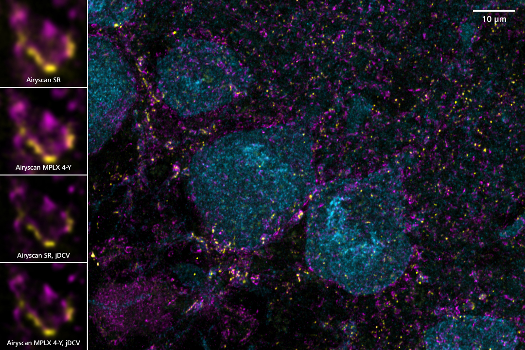 10 µm mouse brain section, Calbindin-A488 (blue), Gephyrin-A568 (yellow), VGAT-A647 (magenta). 