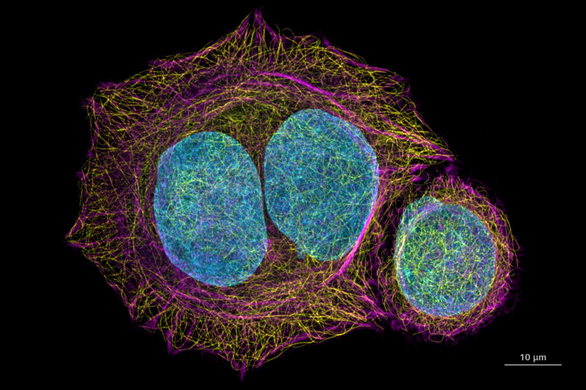 HeLa cells stained for DNA (blue, Hoechst 44432), microtubules (yellow, anti-tubulin Alexa 488) and F-actin (magenta, phalloidin Abberior STAR Red). Imaged with ZEISS Airyscan 2 in Multiplex mode. 