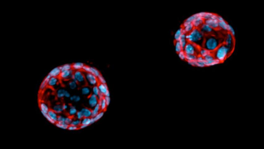 Captura de imágenes de organoides del cáncer