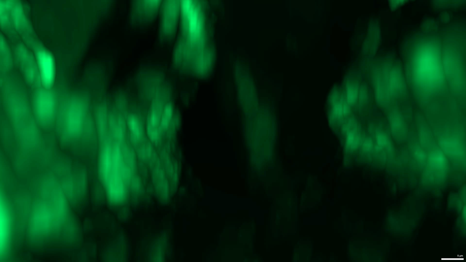 Hipocótilo (tallo) de Arabidopsis thaliana transgénico de 3 días de edad