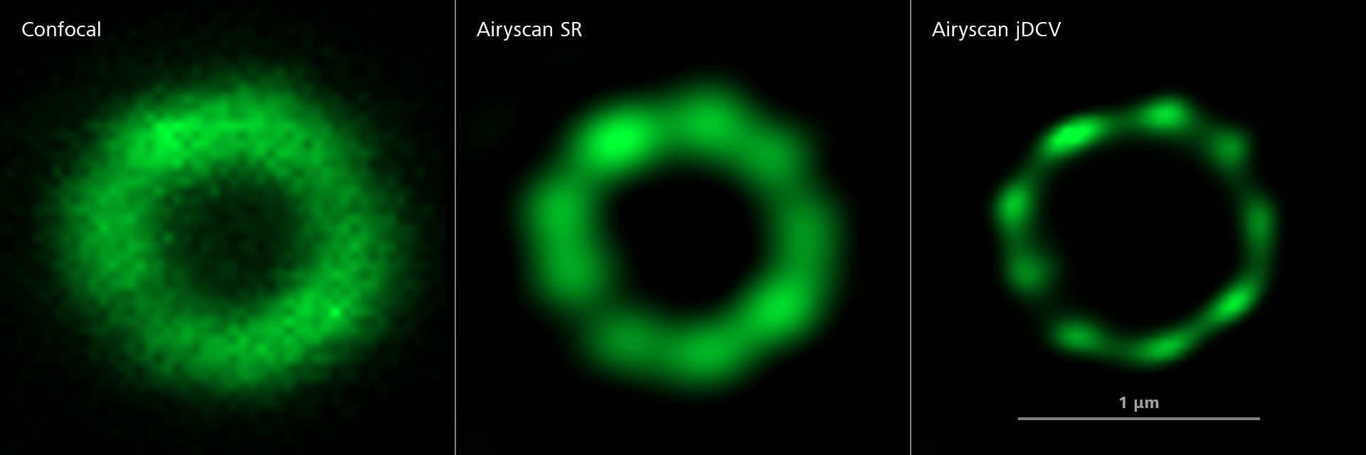 共焦点画像（左）とAiryscan SR（中央）およびAiryscanジョイントデコンボリューション（右）との比較。HeLa細胞、4倍拡大、アセチル化α-チューブリン（緑）で標識。