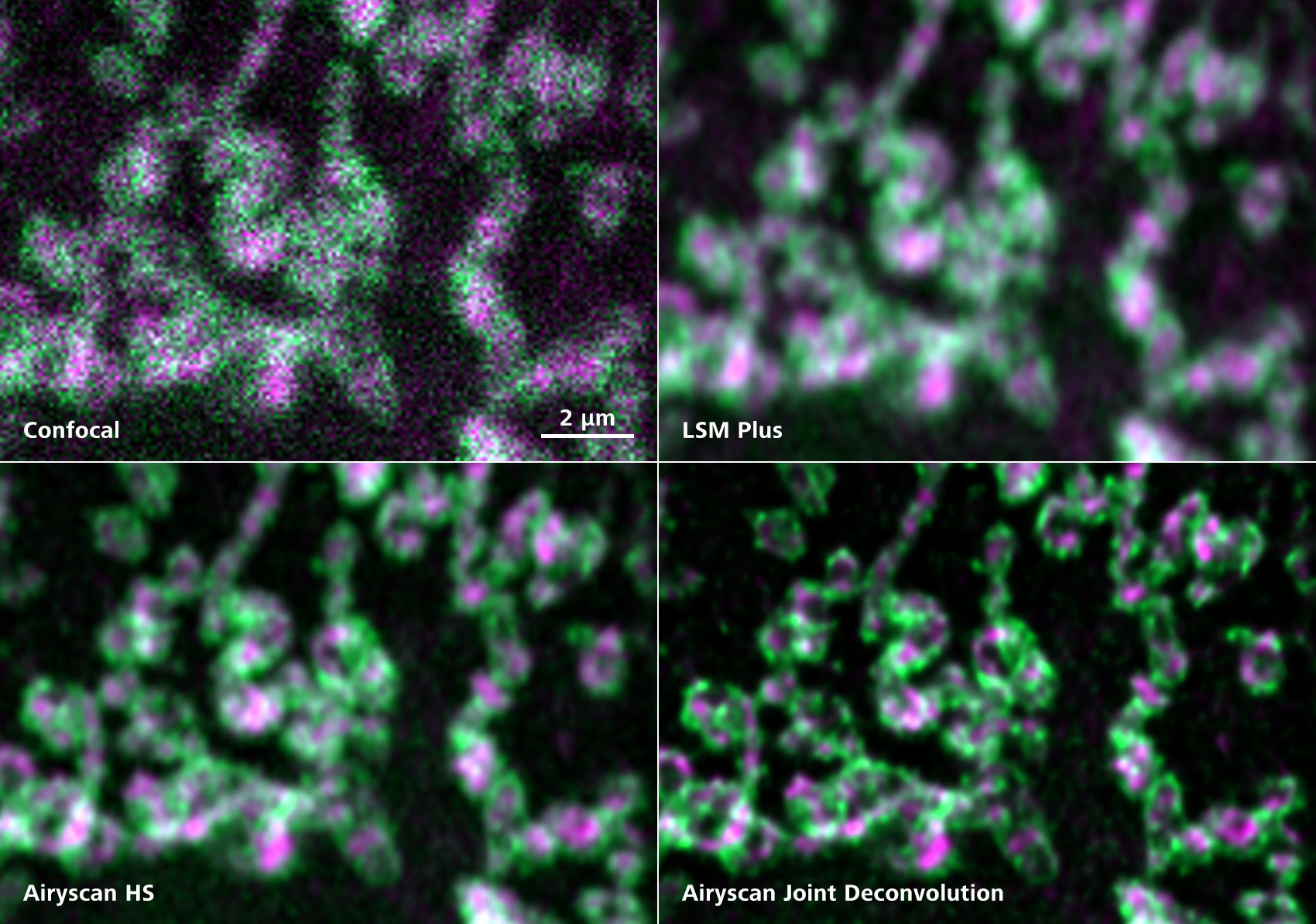  Structures mitochondriale dans des cellules COS-7 Échantillon avec l'aimable autorisation de Zhang Y, Université des sciences et technologie de Chine, Chine. 