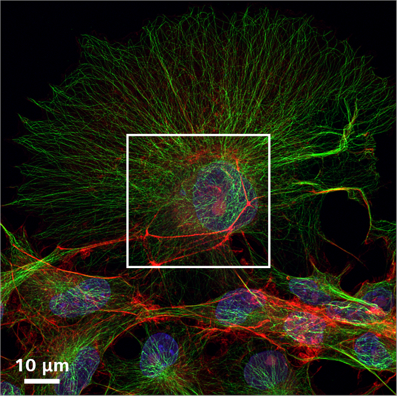 Comparing the field of view you can image at superresolution in the same time using Multiplex mode.