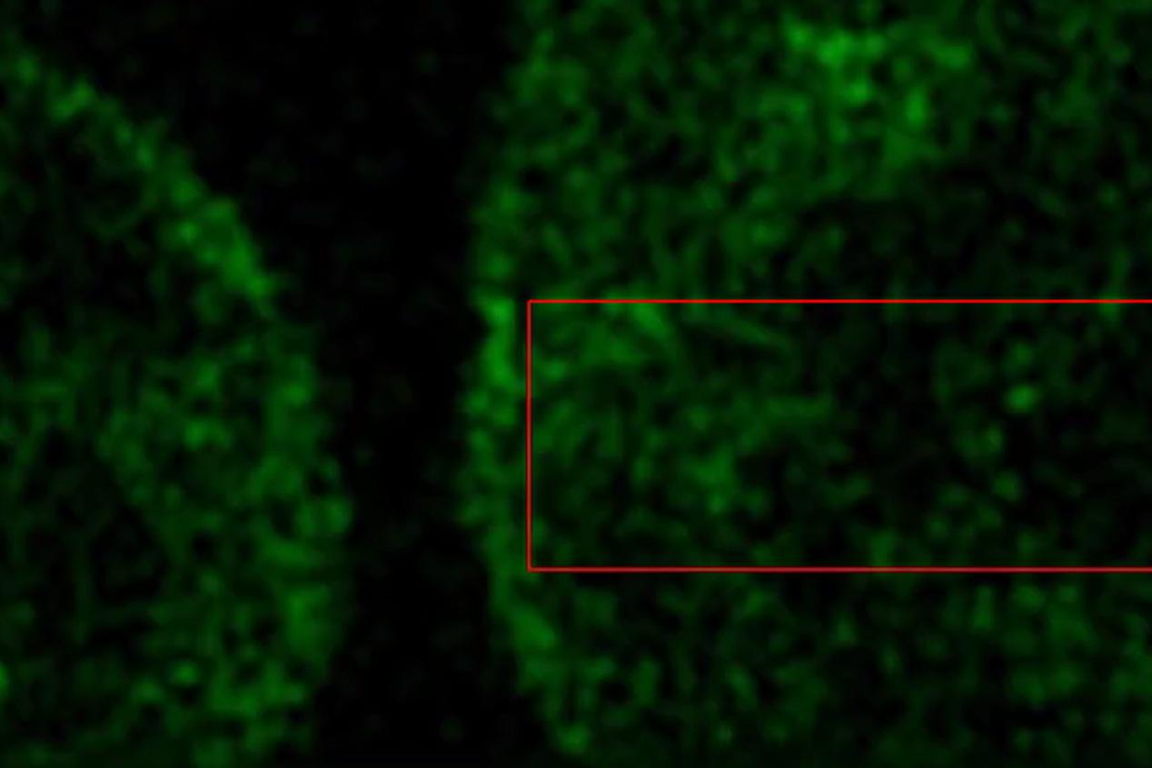 Nuclei of Living HeLa Cells