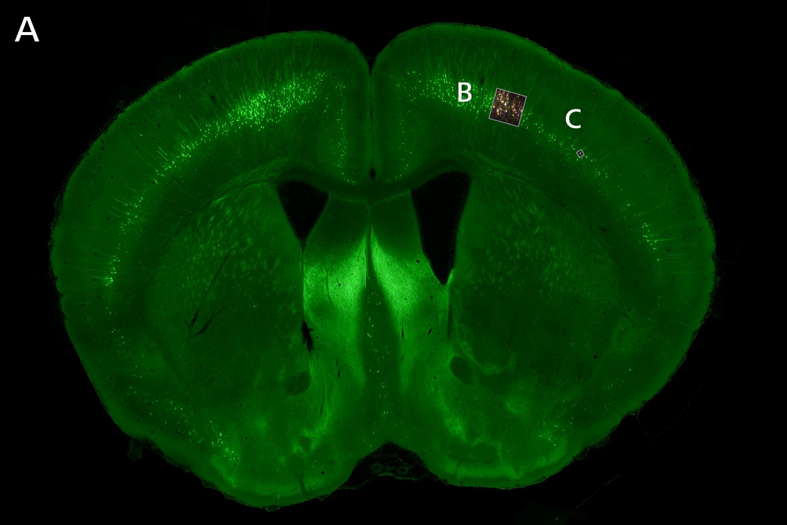 Overview image. Section of a Thy1-YFP mouse brain on ZEISS Axio Scan.Z1.