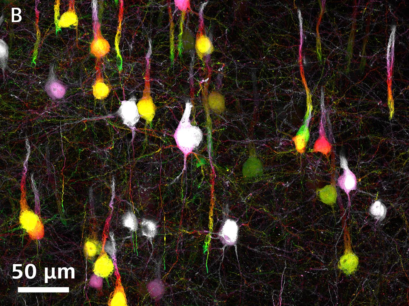 Réseau neuronal. L'encadré montre des ROI agrandies sur ZEISS LSM avec Airyscan 