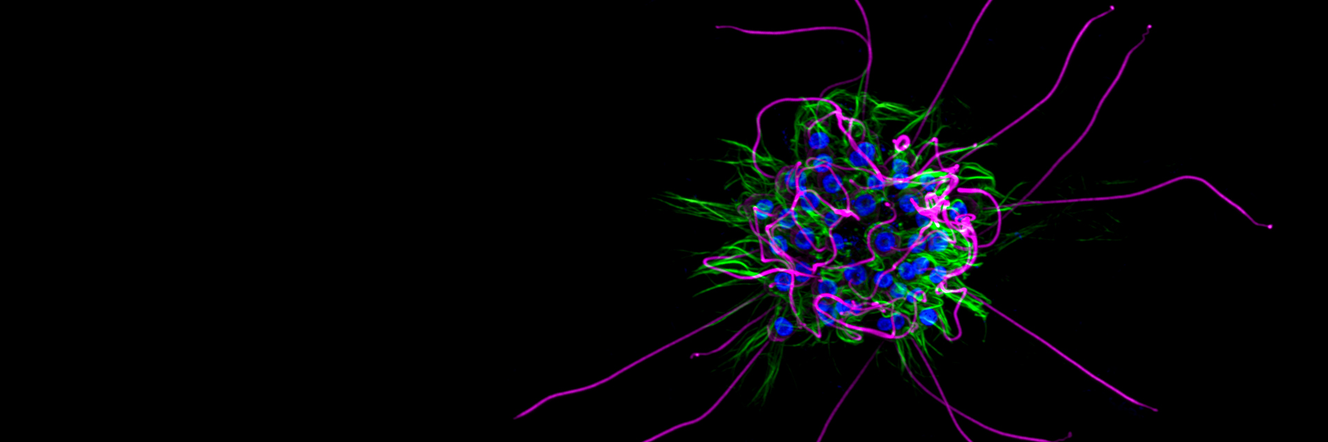 Choanoflagellate rosette colony. Image courtesy of Kayley Hake. King Lab. University of California, Berkeley.