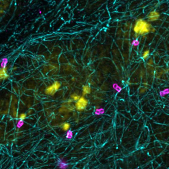 Espermatogonia en testículo de Drosophila. Marcador multicolor con asterless (magenta), tubulina acetilada (cian) y Hoechst 33258 (amarillo). Imagen captada con ZEISS Airyscan 2 seguida de la tecnología Joint Deconvolution.