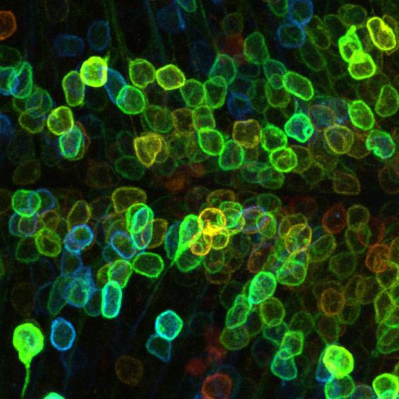 Live-Imaging mit LSM Plus: An der Plasmamembran lokalisierte Expression von Wnt3-EGFP im sich entwickelnden optischen Tectum eines vier Tage alten Zebrafischs.