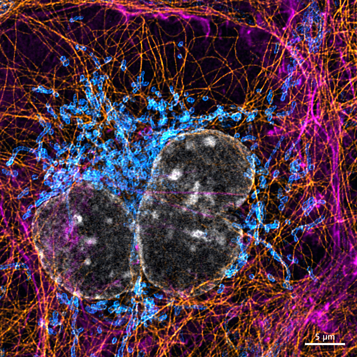 COS-7細胞はDAPI（核、白）、Anti-TOM 20（Alexa 488、青）、Anti-Tubulin（Alexa 555、橙）、およびActin-SiR（アクチン、マゼンタ）で標識されています。