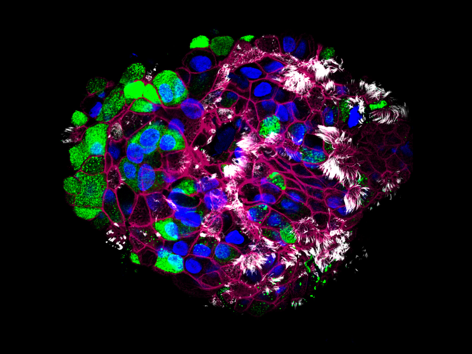 Organoïde de poumon distal humain montrant des cellules en massue et des cellules ciliées, évidé depuis 10 jours.  Avec l'aimable autorisation du Prof. C. Kuo, Service de médecine, hématologie, Stanford University, États-Unis 