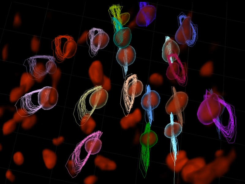 ゼブラフィッシュ胚の拍動する心臓における核の追跡。ご提供：Toby Andrews and Rashmi Priya, The Francis Crick Institute, London, UK.