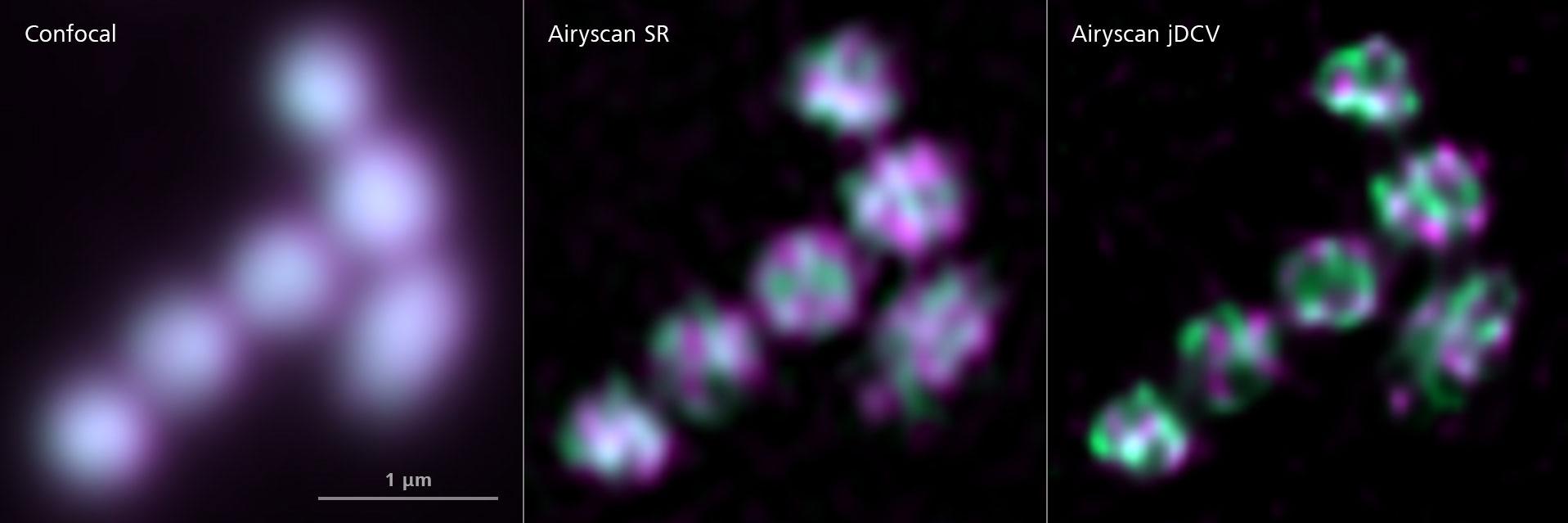 Mitochondrien in einer Ackerschmalwand-Zelle (Arabidopsis thaliana). Vergleich zwischen einer konfokalen Aufnahme, einer Aufnahme mit Airyscan SR und einer Aufnahme mit Airyscan Joint Deconvolution.