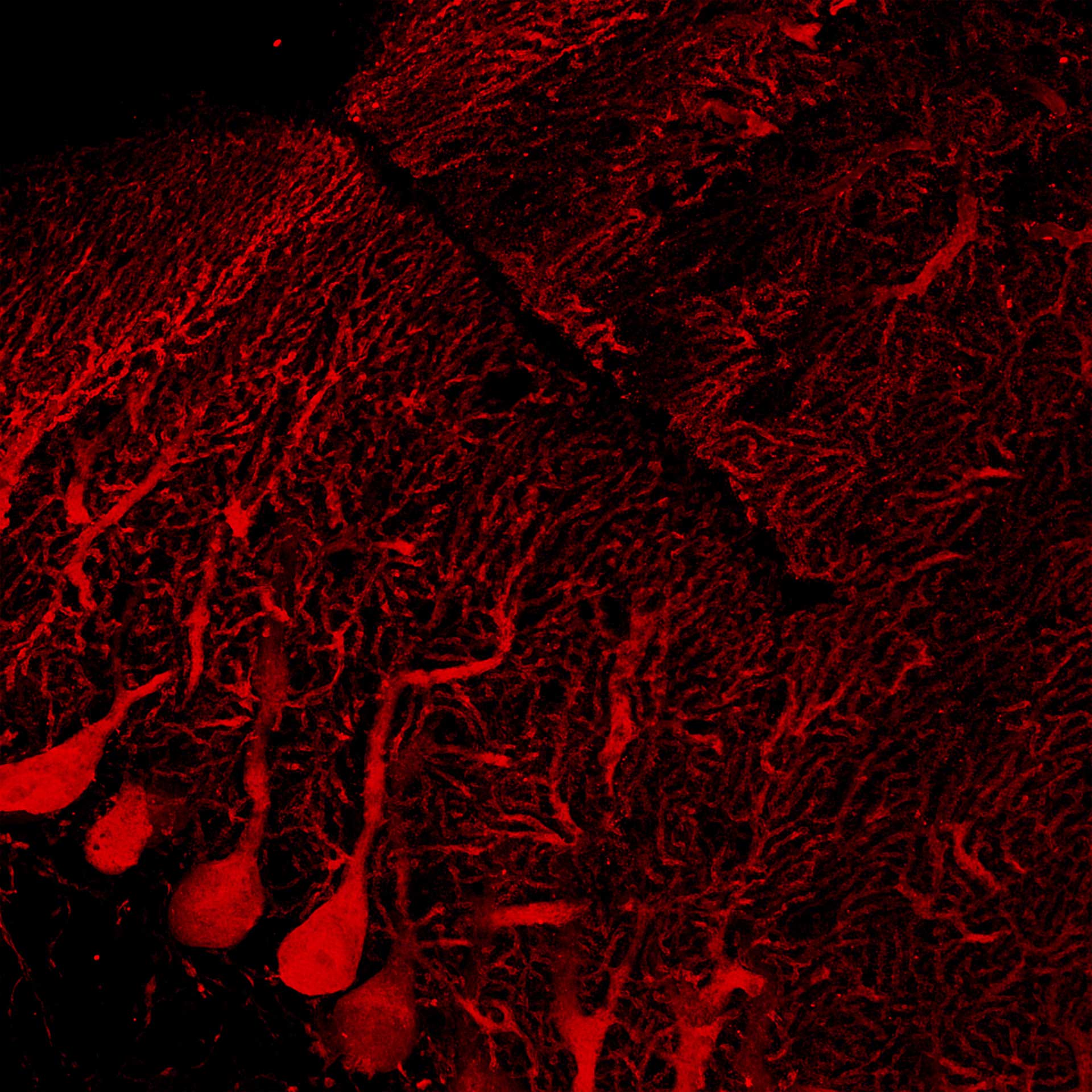 Mouse brain cerebellum labelled with anti-calbinding (Alexa-568) and anti-GFAP (Alexa-488).  Sample courtesy of L. Cortes, University of Coimbra, Portugal.