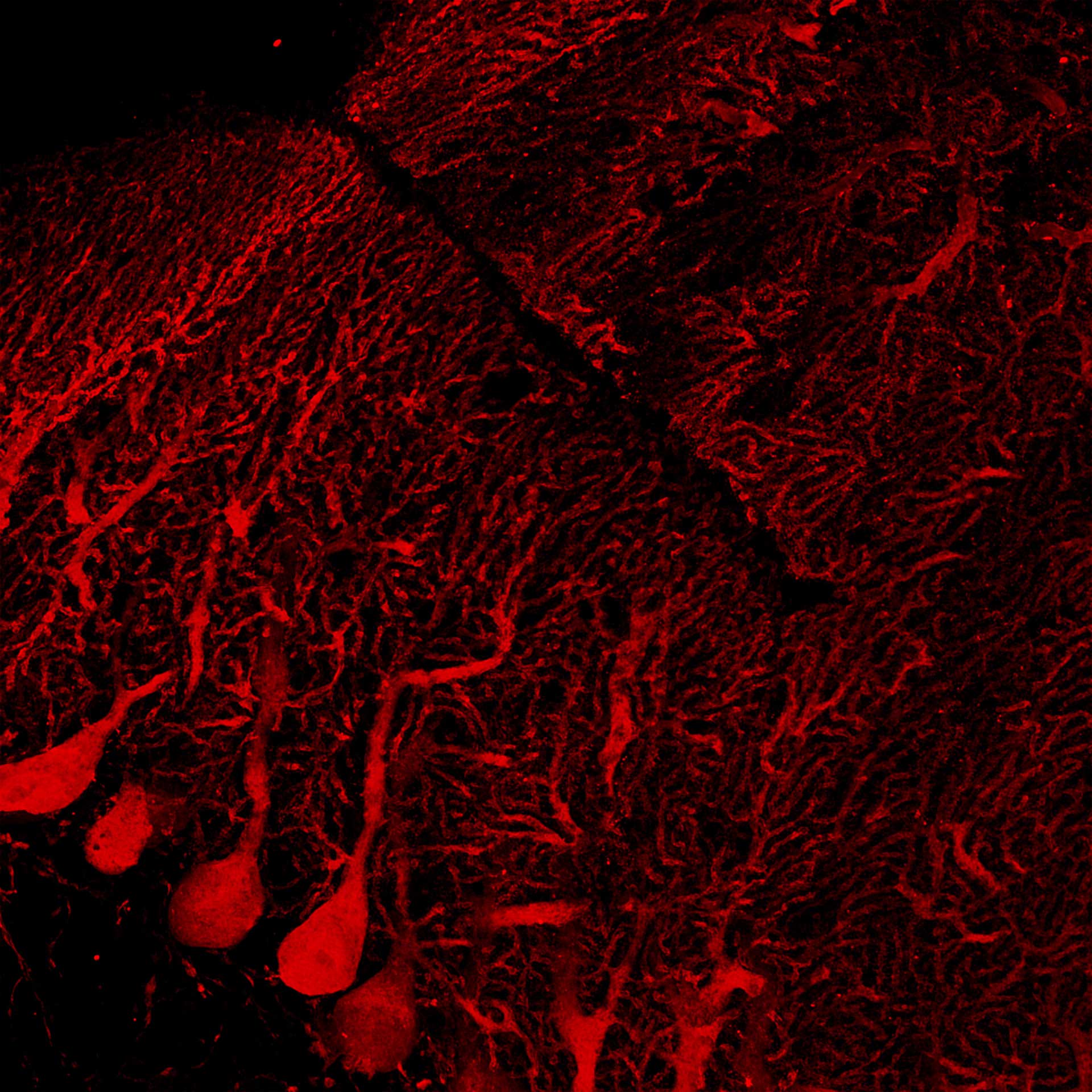 Cervelet de souris marqué avec de l'anti-calcaire (Alexa-568) et de l'anti-GFAP (Alexa-488).  Échantillon : avec l'aimable autorisation de L. Cortes, Université de Coimbra, Portugal.