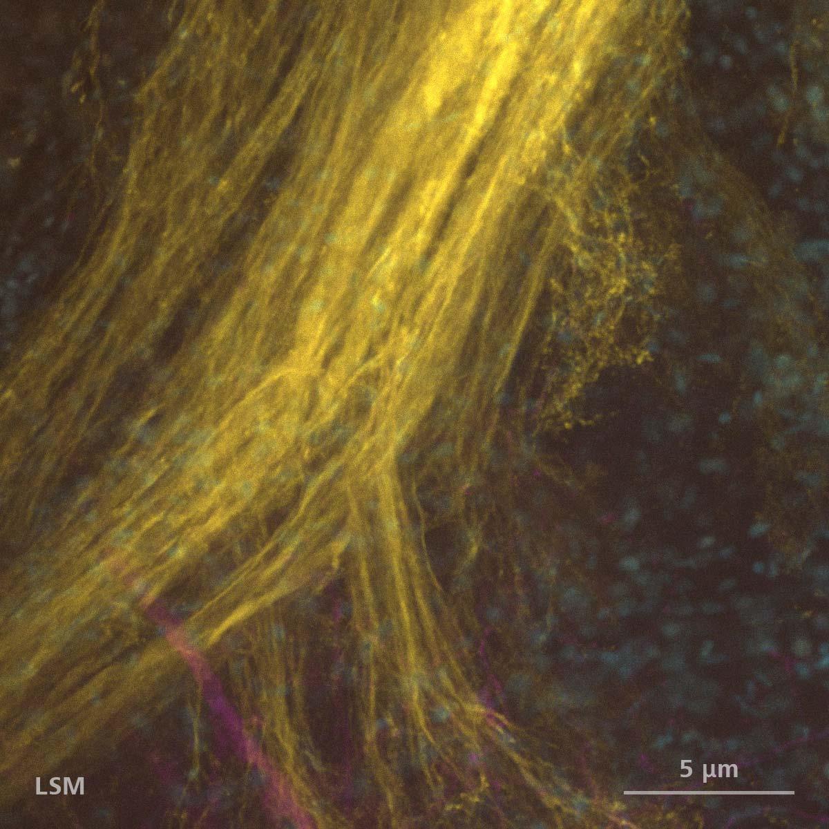 LSM Plus不使用時のゴキブリの脳のニューロン（Alexa 488：黄、Alexa 647：マゼンタ）およびDNA（Hoechst：シアン）。