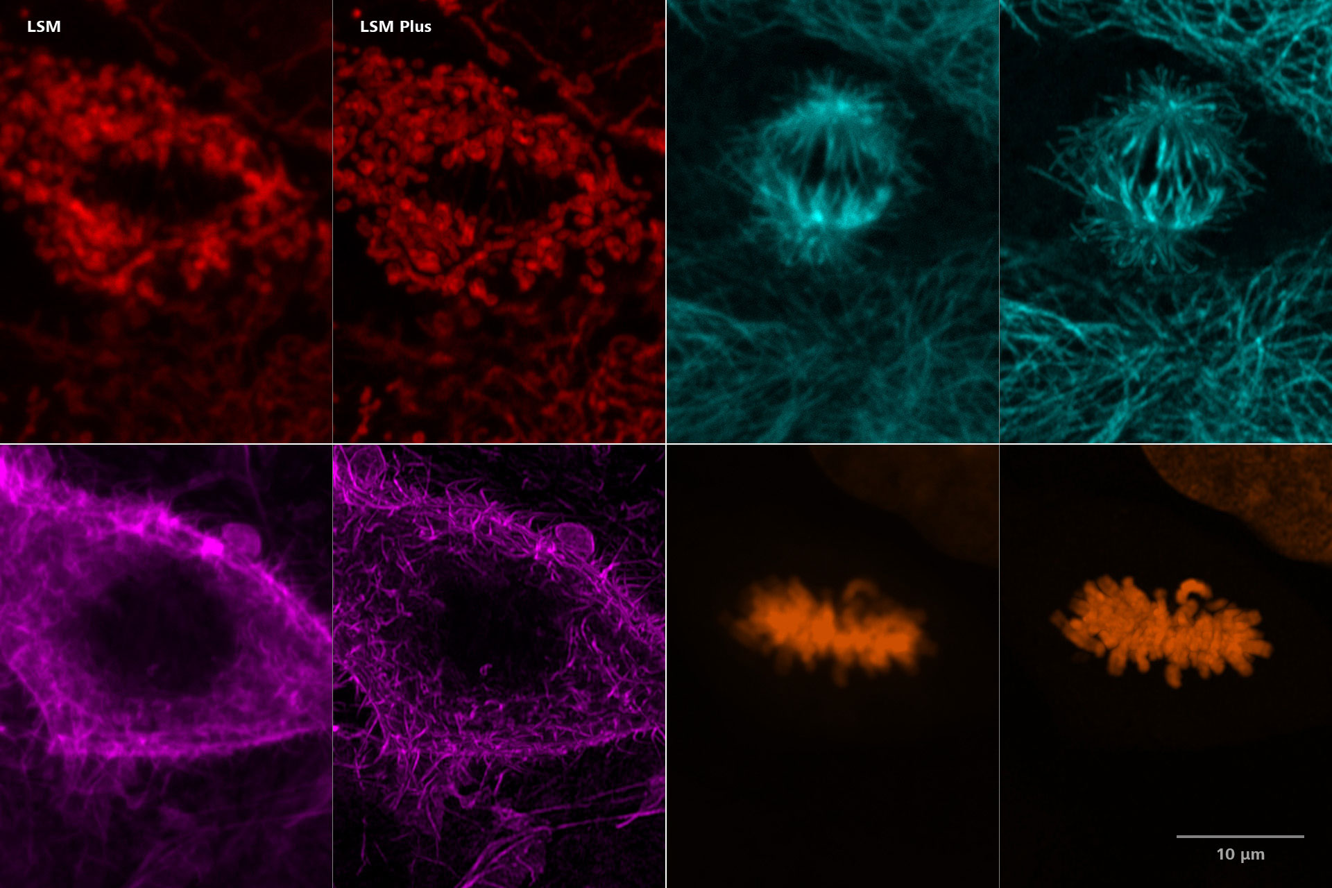 Cellules Cos-7 Anti-TOM20 AF750 (rouge), anti-tubuline AF700 (cyan), actine phalloïdine-OG488 (magenta), DAPI (orange). Image acquise avec le LSM Plus incluant le détecteur ZEISS NIR en mode canal. Échantillon : avec l'aimable autorisation d'U. Ziegler et J. Doehner, Université de Zurich, ZMB, Suisse.
