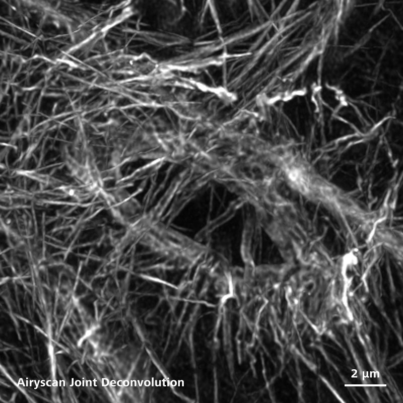 Coloration à la F-actine (phalloïdine) d'un canal annulaire dans la chambre d'œuf d'une drosophile.