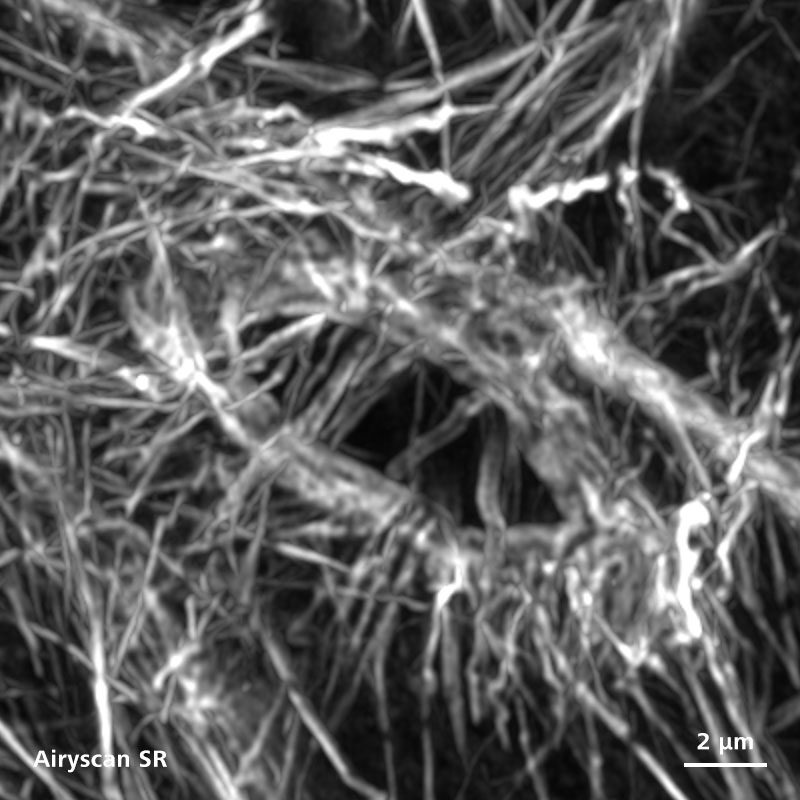 Angefärbtes F-Aktin (Phalloidin) im Ringkanal der Eikammer einer Drosophila.