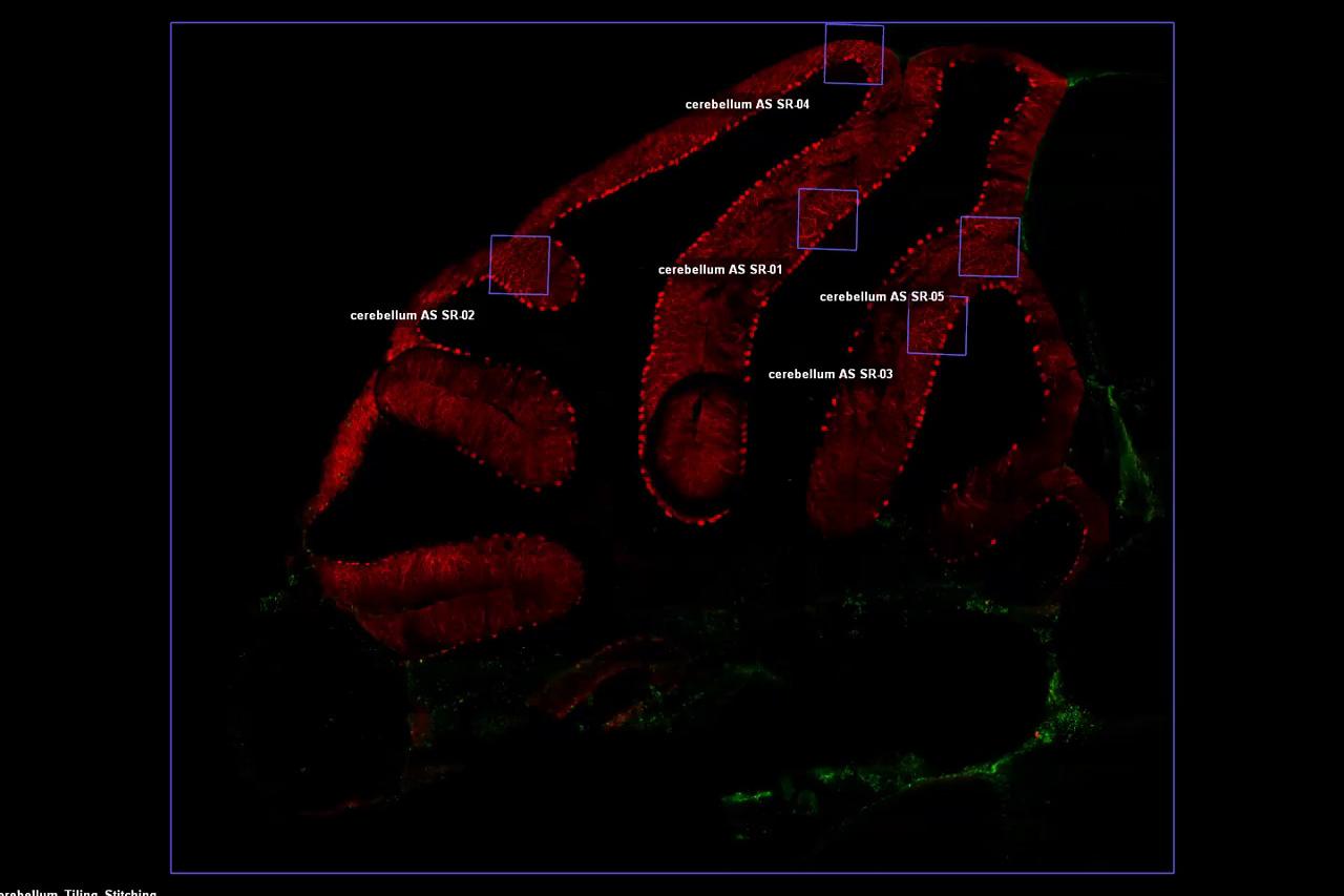 抗カルビンジン（Alexa-568）および抗GFAP（Alexa-488）で標識されたマウス小脳