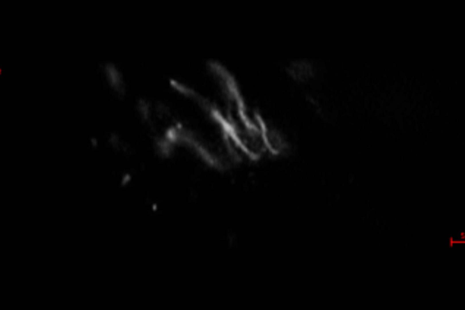 Captura de imágenes en directo con 143 fotogramas por segundo de cilios móviles marcados con fluorescencia de epéndimo cerebral. 