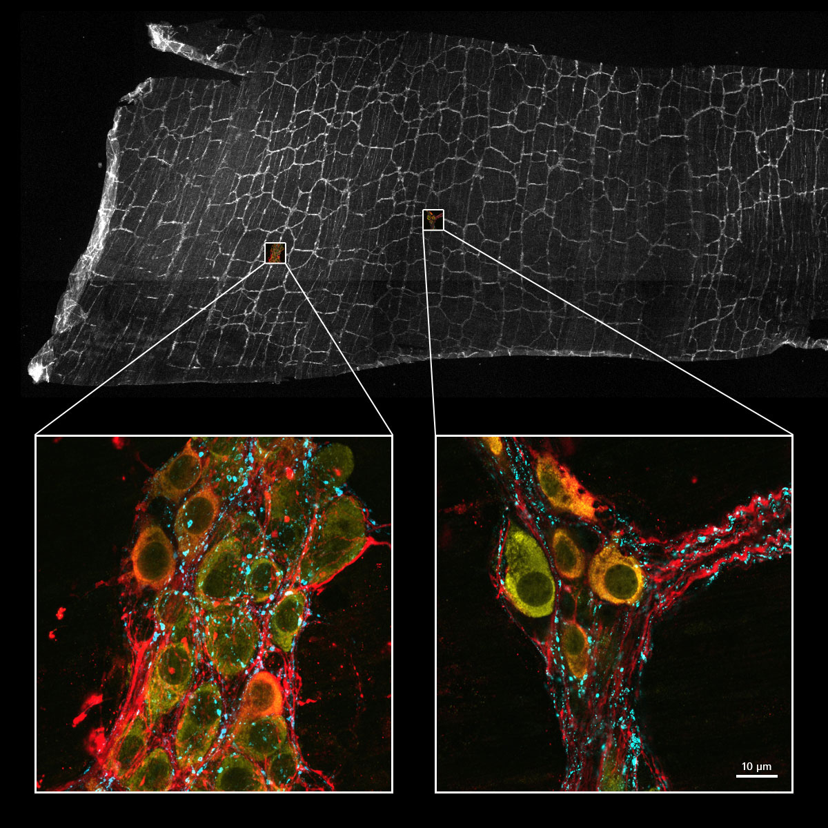 Mouse intestine tissue section stained for Substance P (cyan, Alexa 488) labeling the presynaptic contacts in the enteric nervous system, HuC/D (yellow, Alexa 568) labeling the enteric neurons, and neuronal Nitric Oxide Synthase (nNOS, red, Alexa 750) labeling a sub-population of enteric neurons. Sample Courtesy of Pieter Vanden Berghe, LENS & CIC, University of Leuven, Belgium. Sample Courtesy of Pieter Vanden Berghe, LENS & CIC, University of Leuven, Belgium.