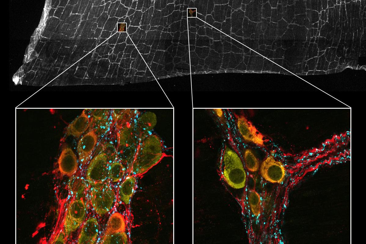 Coupe tissulaire colorée d'un intestin de souris pour la substance P (cyan, Alexa 488) marquant les contacts présynaptiques dans le système nerveux entérique, HuC/D (jaune, Alexa 568) marquant les neurones entériques, et la synthase d'oxyde nitrique neuronale (nNOS, rouge, Alexa 750) marquant une sous-population de neurones entériques. Échantillon : avec l'aimable autorisation de Pieter Vanden Berghe, LENS & CIC, Université de Louvain, Belgique.