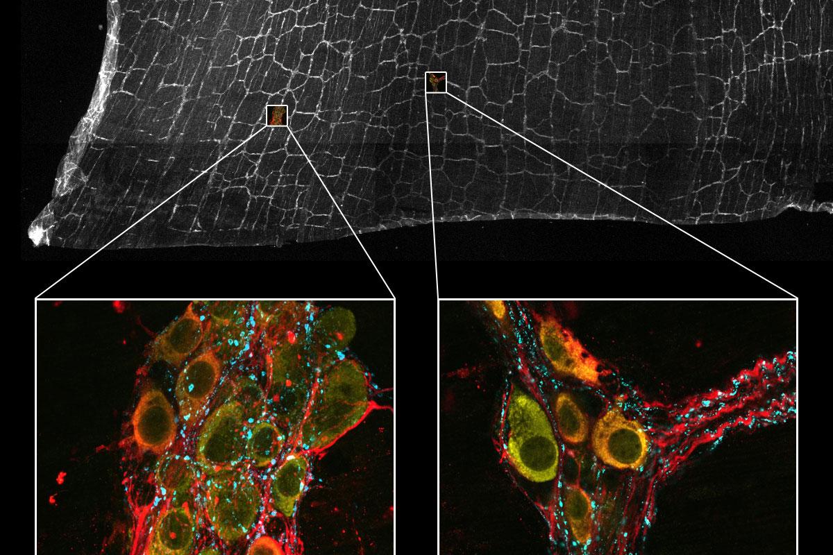 Coupe tissulaire colorée d'un intestin de souris pour la substance P (cyan, Alexa 488) marquant les contacts présynaptiques dans le système nerveux entérique, HuC/D (jaune, Alexa 568) marquant les neurones entériques, et la synthase d'oxyde nitrique neuronale (nNOS, rouge, Alexa 750) marquant une sous-population de neurones entériques. Échantillon : avec l'aimable autorisation de Pieter Vanden Berghe, LENS & CIC, Université de Louvain, Belgique.