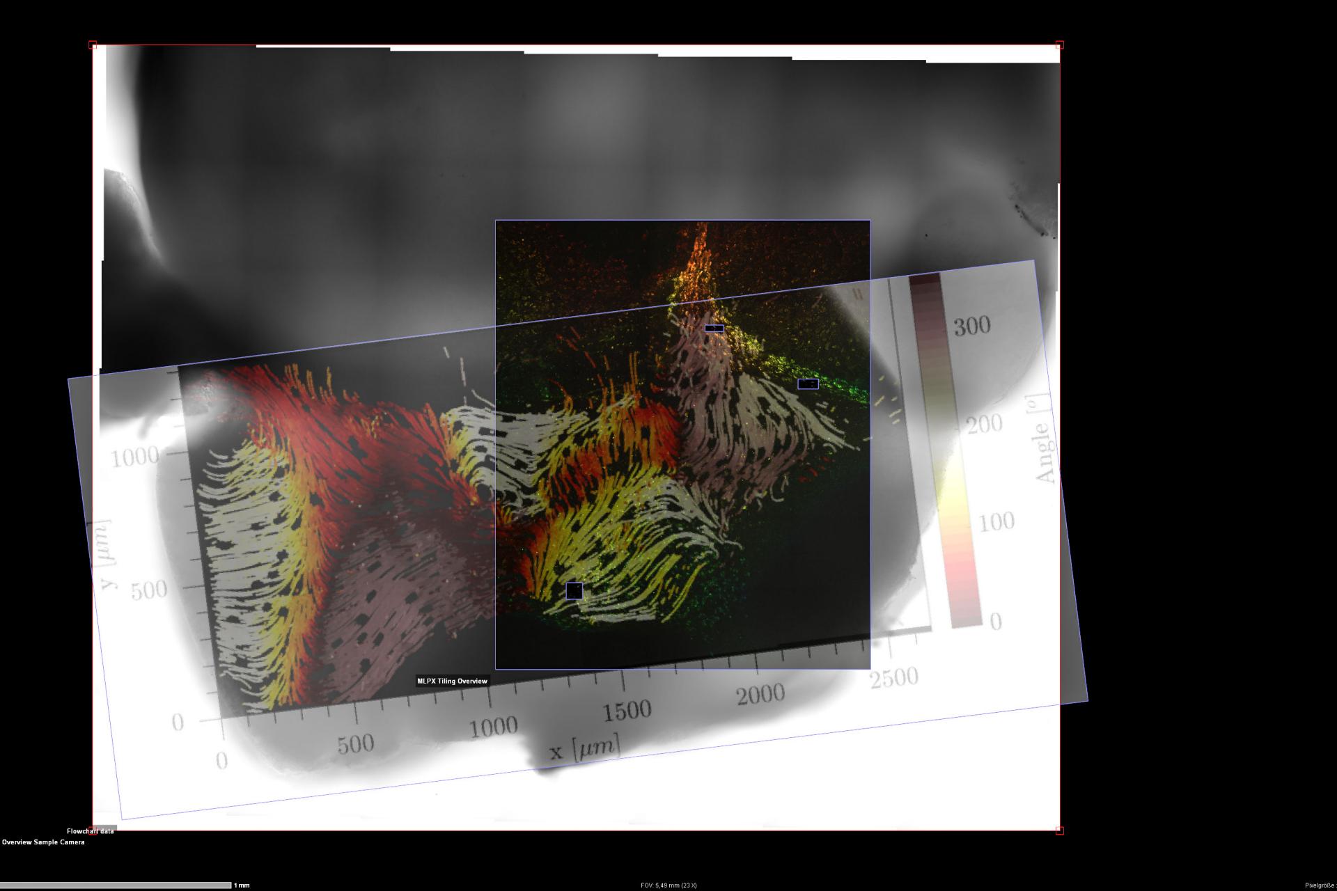 This ZEN Connect project documents the experiment performed with the tissue explant of ependyma from the ventricular system of a mouse brain. 