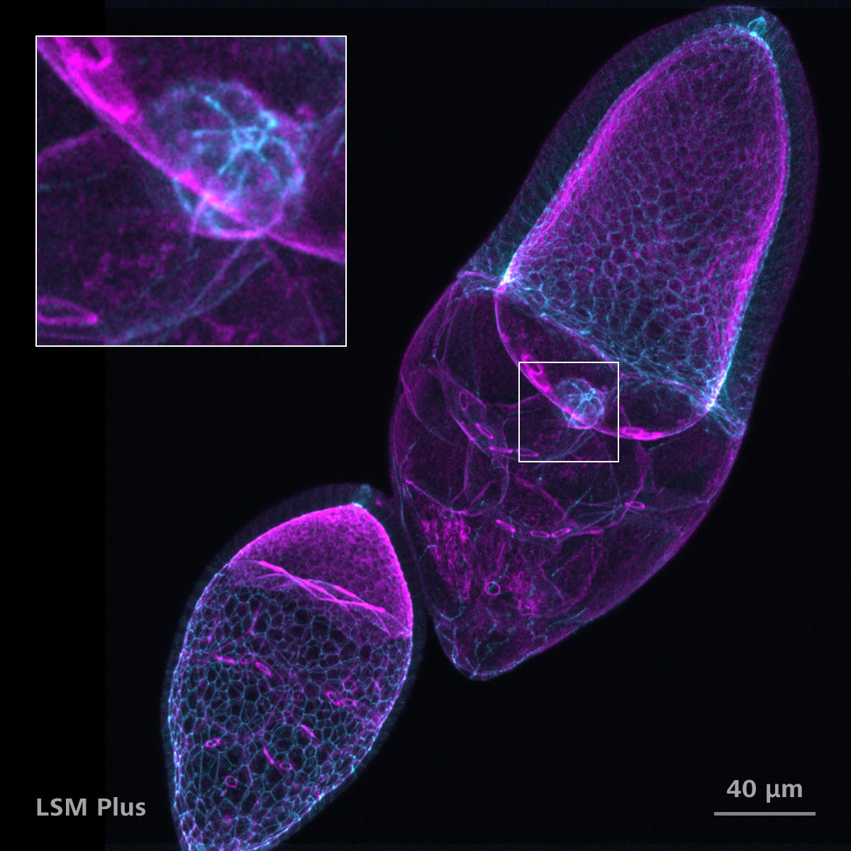果蝇卵巢，F-肌动蛋白（鬼笔环肽，品红色）和DE-钙粘蛋白（青色）染色。样品由德国明斯特大学Luschnig工作小组的T. Jacobs和明斯特成像网络的T. Zobel提供