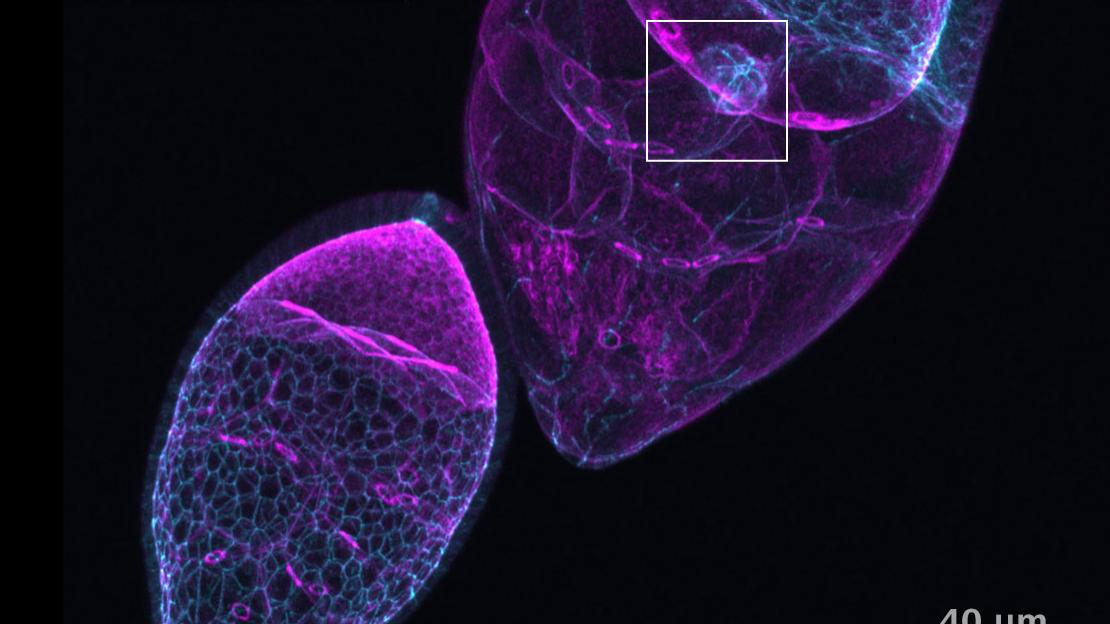 3D Organoid, sub cellular structures (Epithelial Cell Layer and Inner Lumen).  Study the role of Wnt signaling in organoid formation. Acquired with ZEISS Celldiscoverer 7 Confocal scan with Airyscan.
