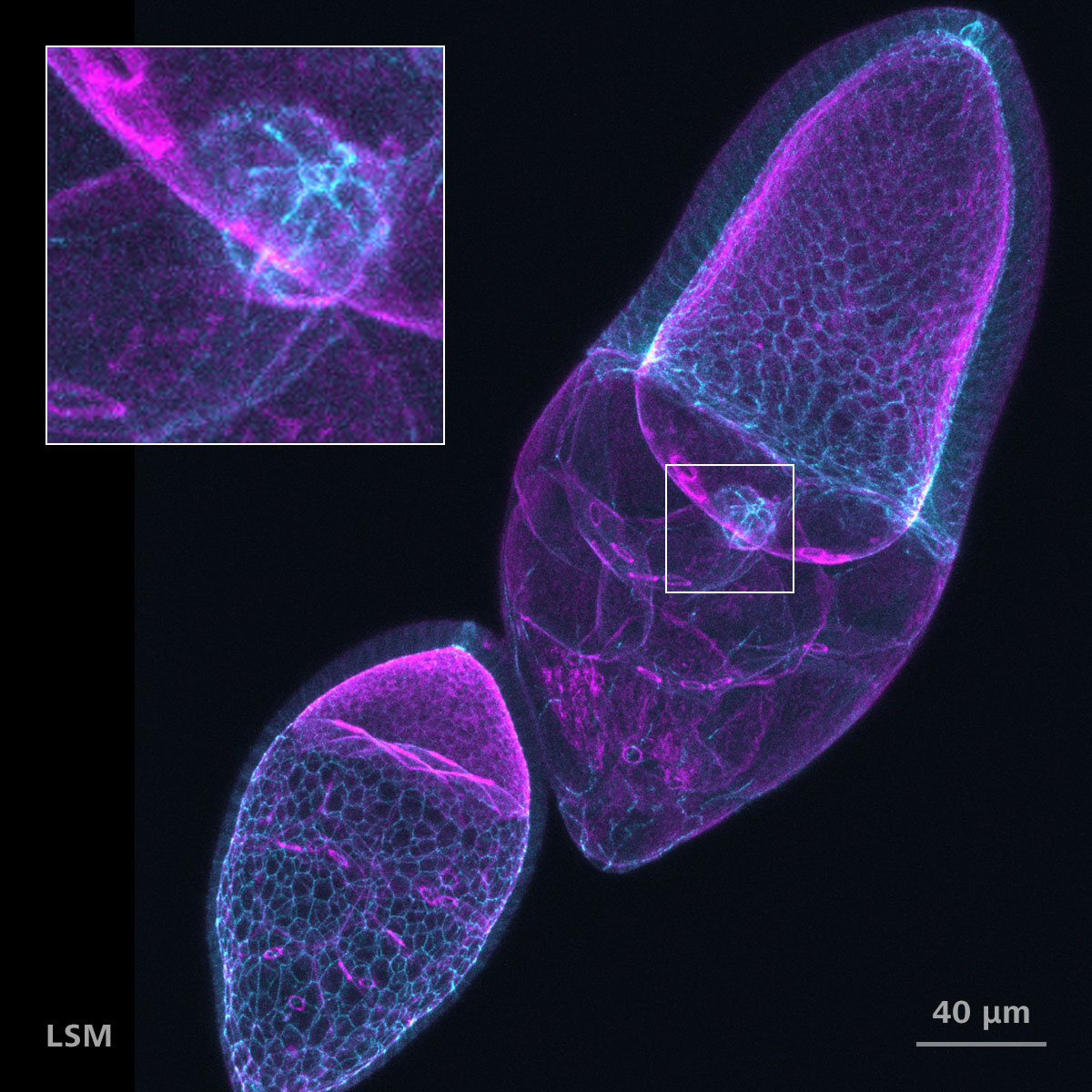 Cámaras ováricas de Drosophila teñidas para F-actina (faloidina, magenta) y DE-cadherina (cian). Cortesía de T. Jacobs, AG Luschnig, WWU Münster; con T. Zobel, Münster Imaging Network, Alemania