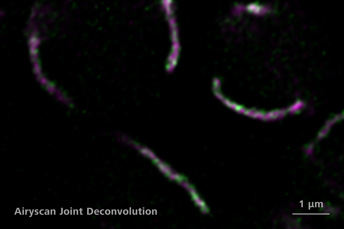 芽殖酵母细胞，蛋白质定位到线粒体内膜（绿色）和线粒体基质（品红色）。样品由美国加利福尼亚大学戴维斯分校的K. Subramanian和J. Nunnari提供