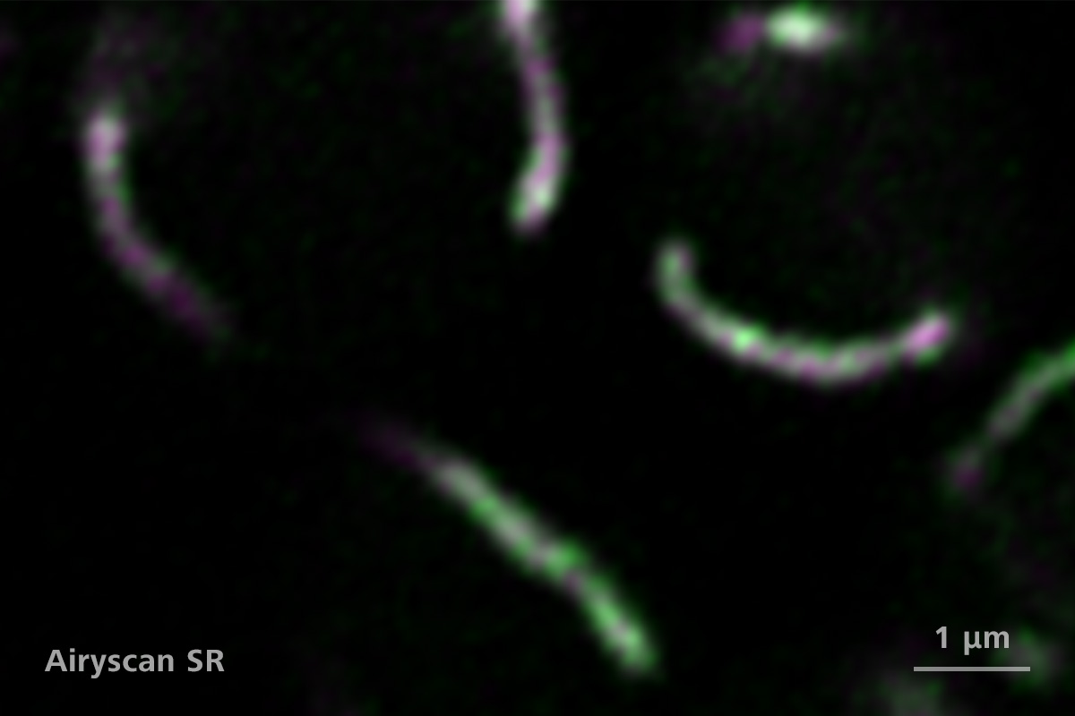 Budding yeast cells with protein localized to the mitochondrial inner membrane (green) and mitochondrial matrix (magenta). 
