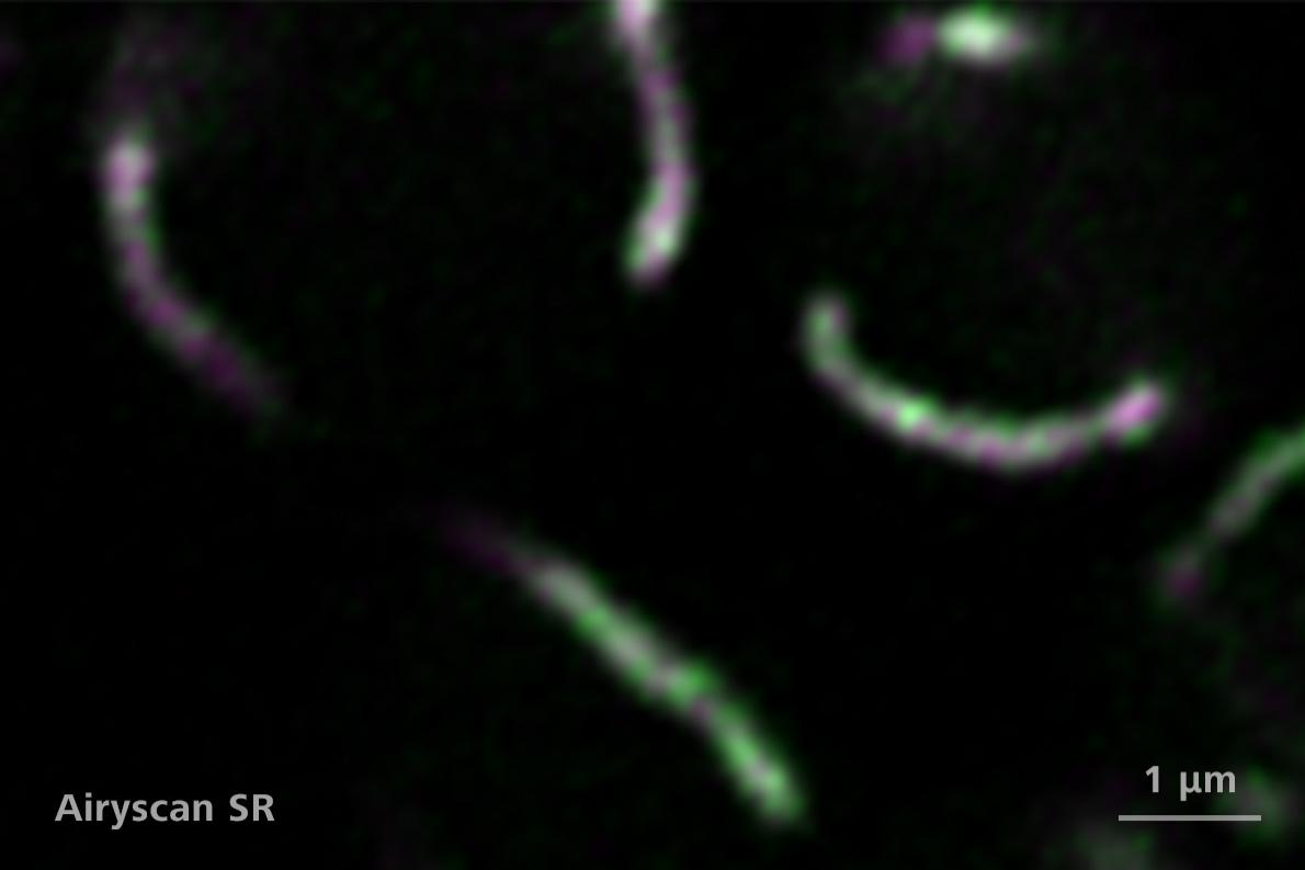 芽殖酵母细胞，蛋白质定位到线粒体内膜（绿色）和线粒体基质（品红色）。样品由美国加利福尼亚大学戴维斯分校的K. Subramanian和J. Nunnari提供