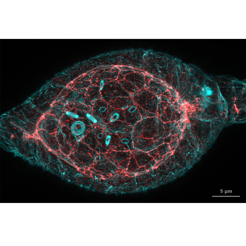 Germarium einer Drosophila. Aufgenommen mit ZEISS Airyscan 2, im Anschluss verarbeitet mit Joint Deconvolution. Mit freundlicher Genehmigung von T. Jacobs, AG Luschnig, WWU Münster; mit T. Zobel, Münster Imaging Network, Deutschland 